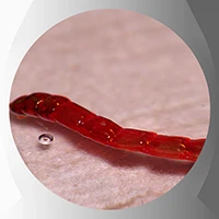Blood worm
